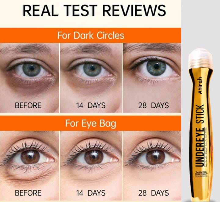 Anti Dark Circle Serum