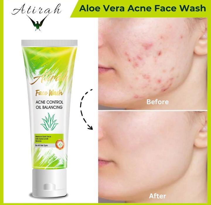 Face Wash – Acne Control